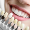 Correcting Uneven or Misshapen Teeth: A Complete Guide to Cosmetic Dentistry