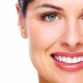 Application of Bonding Material for a Beautiful Smile