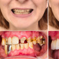 How to Improve the Appearance of Your Teeth and Smile