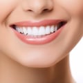 Polishing and Smoothing: Enhancing Your Smile Through Cosmetic Dentistry