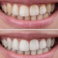 Evaluation of Tooth Shape and Structure: Improving Your Smile Through Cosmetic Dentistry