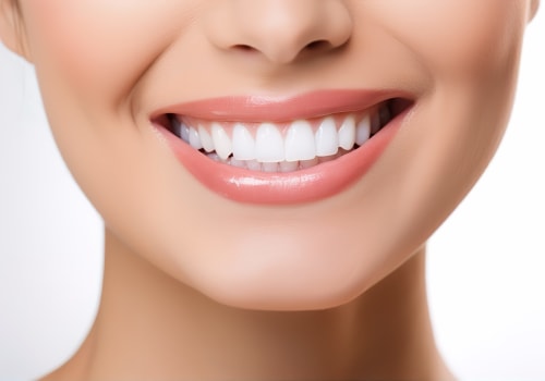 Replacing Bonding: Improving Your Smile with Cosmetic Dentistry