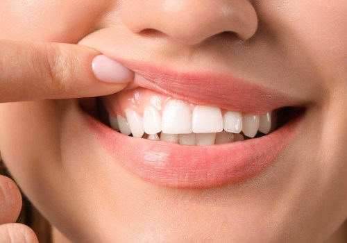 The Power of Genetics: Understanding How It Affects Your Smile